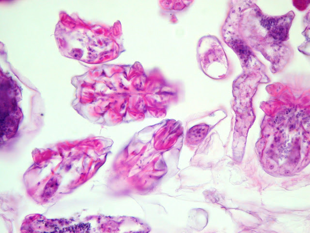 Tiny Mites Living on Your Face Hold the Key to Your ...