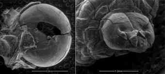 Micrographs of a drone head and larva