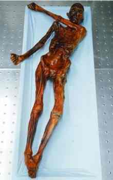 The remains of Ötzi, a Neolithic Iceman who was murdered more than 5,000 years ago