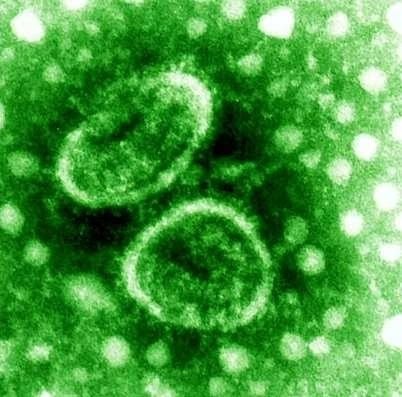 [human_torovirus_gram_colm_wiki_crop[4].jpg]