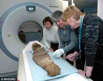 Gender issue: the doctors hope further tests will determine whether the child was a boy or a girl.