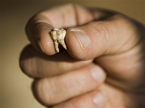[21Mideast_Israel_Ancient_Teeth.sff.s[1].jpg]