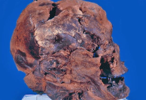 [pg-12-worsley-man_557100s5.jpg]