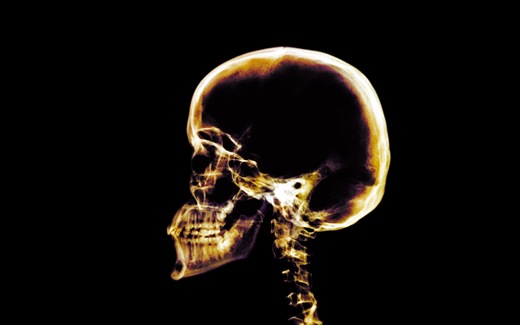 X Ray View Desktop Wallpaper X Ray
View Desktop Wallpaper