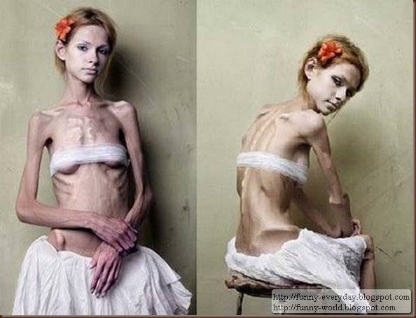 skinny-anorexic-models (1)