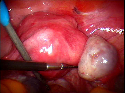 how much caffeine when pregnant