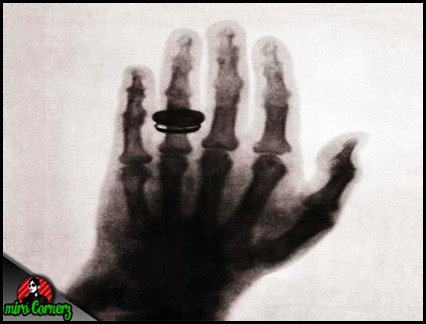 x-ray pertama