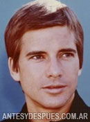 Dirk Benedict, 1974