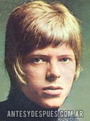 David Bowie,  