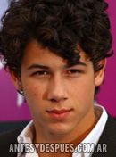 Nick Jonas, 2009