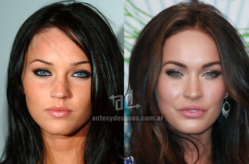 megan fox before surgery and after. Megan Fox before and after the