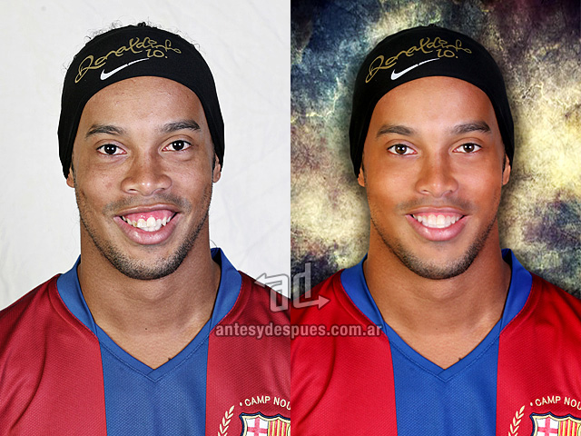 Ronaldinho sin Photoshop
