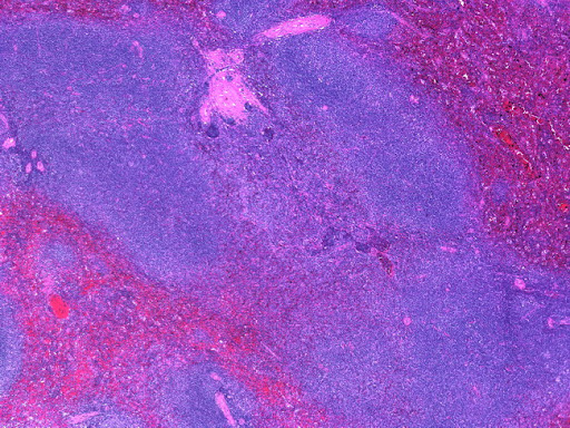 gallbladder location in humans. of stomach Spleen+location