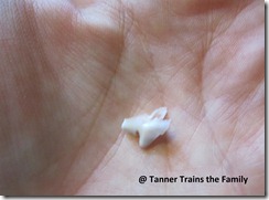 tanner's molar