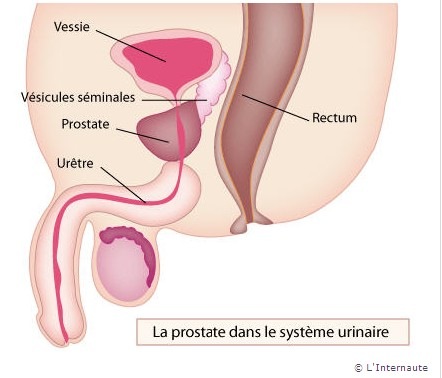 [la prostate L'Internaute[4].jpg]