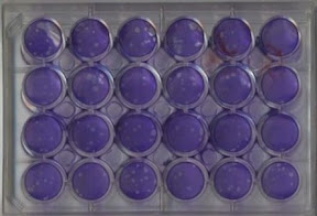 Plages de lyse cellulaire observées lors d'un test de potentiel antiviral avec Herpès simplex de type 1 réalisé en microplaque à 24 puits. Le fond de chaque puit est recouvert d'un tapis cellulaire coloré (bleu); les taches non colorées sont les plages où les cellules ont été infectées et détruites par les virus Plages de lyse cellulaire observées lors d'un test de potentiel antiviral