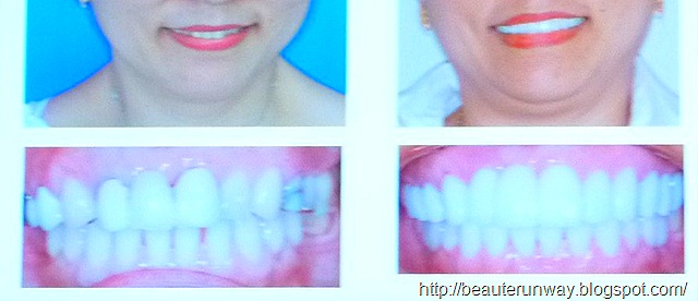 [dental aesthetic makeover patient[1].jpg]