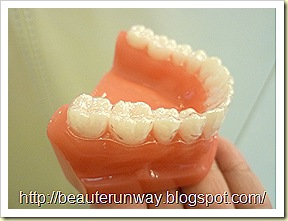 invisalign orchard scotts dental beaute runway 02