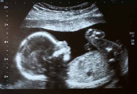 Twenty-Two-Week-Old Baby in Utero