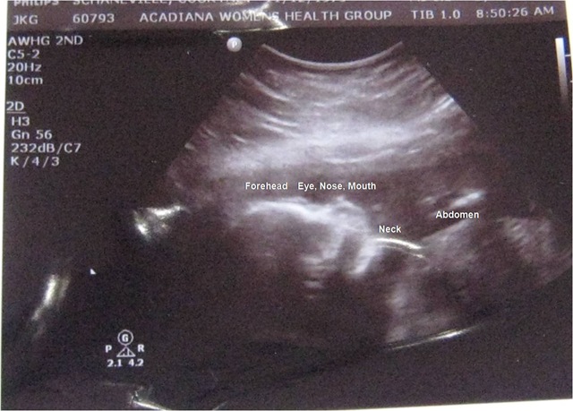 [ultrasound1[8].jpg]