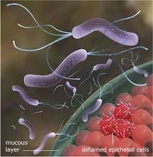 Helicobacter-pylori