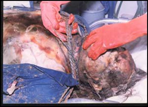 BoerGeocidePoliceforensicexamination farmer hanged then torched