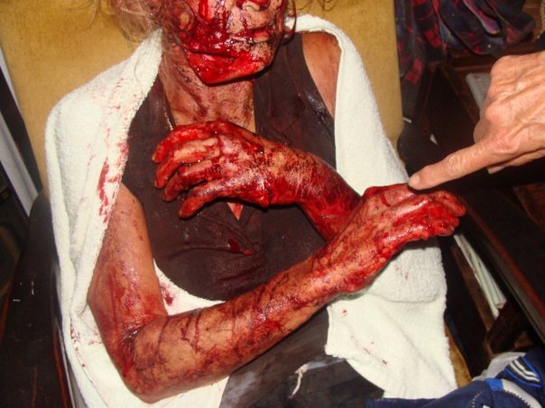 [Eksteen Theresa Jan 25 2010 Stilfontein panga attack victim serious in hospital pic Elria van Schalkwyk Facebook[3].jpg]