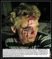 Robindale youth attacked by panga March 242010 Eblockwatch