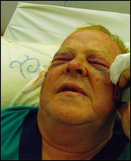 Pretorius Marius top SA eye surgeon attackers tried to gouge out his eyes Vereeniging 20091206
