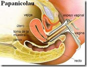 Papanicolau Papanicolau