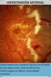 ophthalmology poster 3
