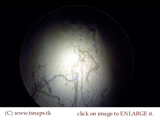 [Compact bone histology slide[2].jpg]