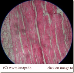 Dense regular connective tissue-Tendon histology slide