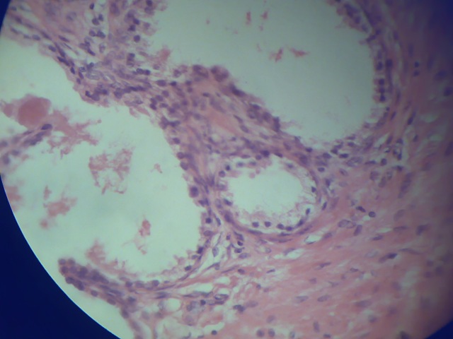 [Cuboidal epithilium histology slide[3].jpg]
