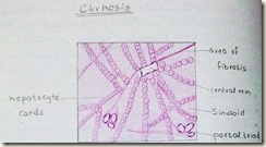 cirrhosis diagram H&E