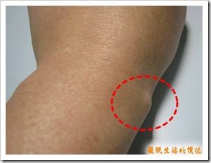 ganglion_before02