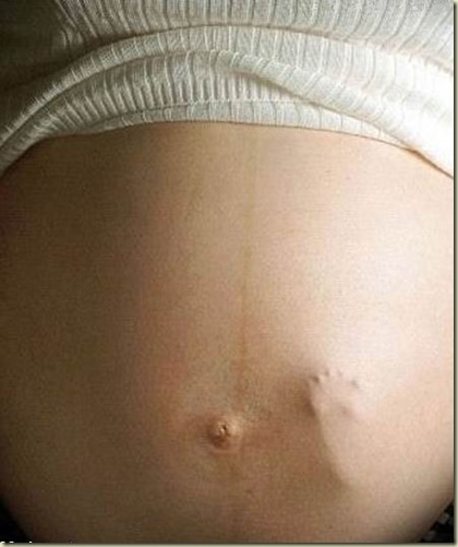 embarazada con el pie del bebe en la panza