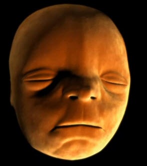 [cara reconstruida de un nasciturus[3].jpg]