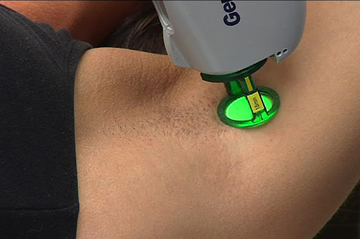 Seringa Laser