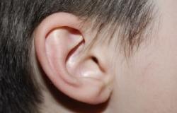 Hearing Problems