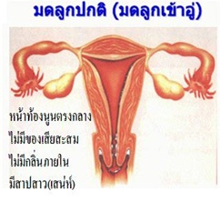 มดลูกปกติ มดลูกปกติ