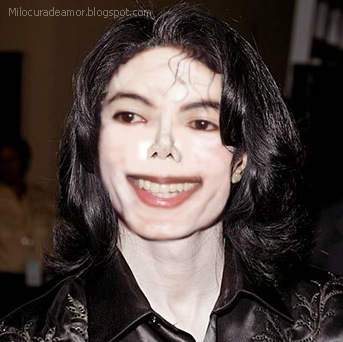 Michael Jackson nariz3