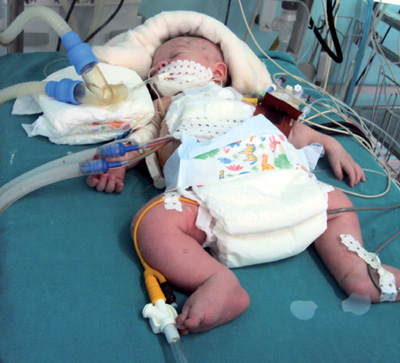 Un Bebe De 11 Jours Sauve In Extremis Algerie360 Un Bebe De 11 Jours Sauve In Extremis Algerie360