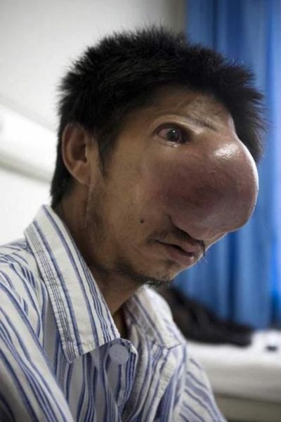 Homem com o maior nariz do mundo