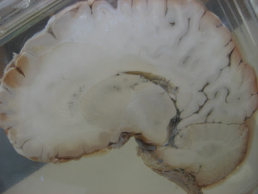 UNLABELED HEART DIAGRAM - Page