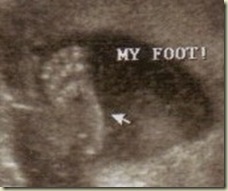 Baby Gril November 16 2009 foot