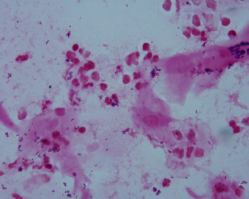 Bacteria 4+ In Stool - all about bacteria images