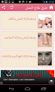 طرق سهلة وسريعة لعلاج النمش