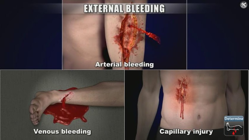 Medrills: Hemorrhage Control Screen 2