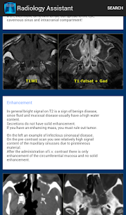 Radiology Assistant - screenshot thumbnail